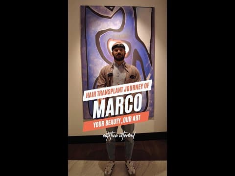 Marco's Hair Transplant in Istanbul — Italian Patient Review