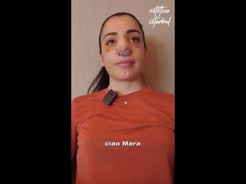 Mara's Rhinoplasty in Istanbul — Italian Patient Review