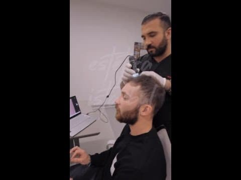 Manuel's Hair Transplant in Istanbul — Full Journey Before & After
