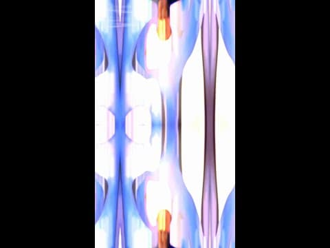 Italian Patient — Hair Transplant in Istanbul