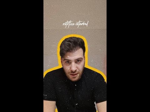 Italian Patient Guido — Hair Transplant in Istanbul