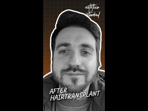 Italian Patient — Hair Transplant in Istanbul