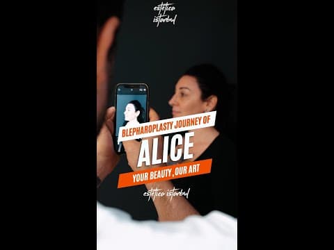 Ana's Blepharoplasty in Istanbul — Italian Patient Review