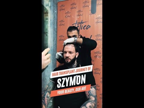 Apteka's Hair Transplant in Istanbul — Polish Patient Review