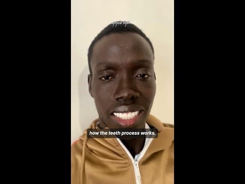 Mahanta's Hollywood Smile in Istanbul — Patient from Senegal