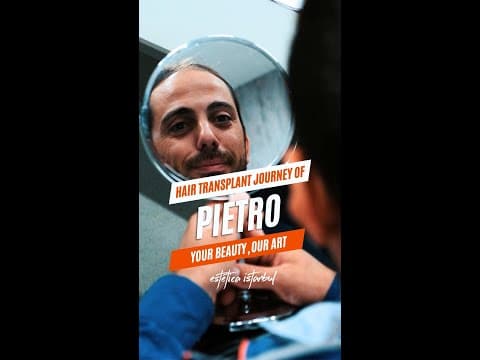 Italian Patients — Hair Transplant in Istanbul