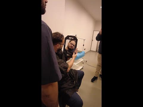 Federico's Hair Transplant in Istanbul — Italian Patient Review