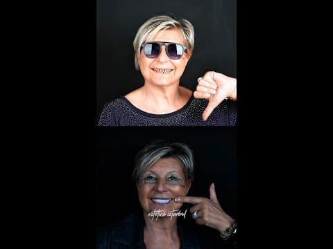 US Patient's Hollywood Smile Transformation in Istanbul