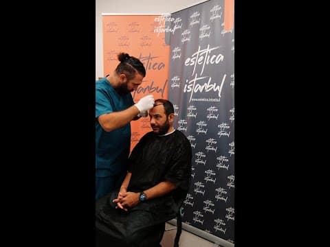 Alessandro's Hair Transplant in Istanbul — Italian Patient Review