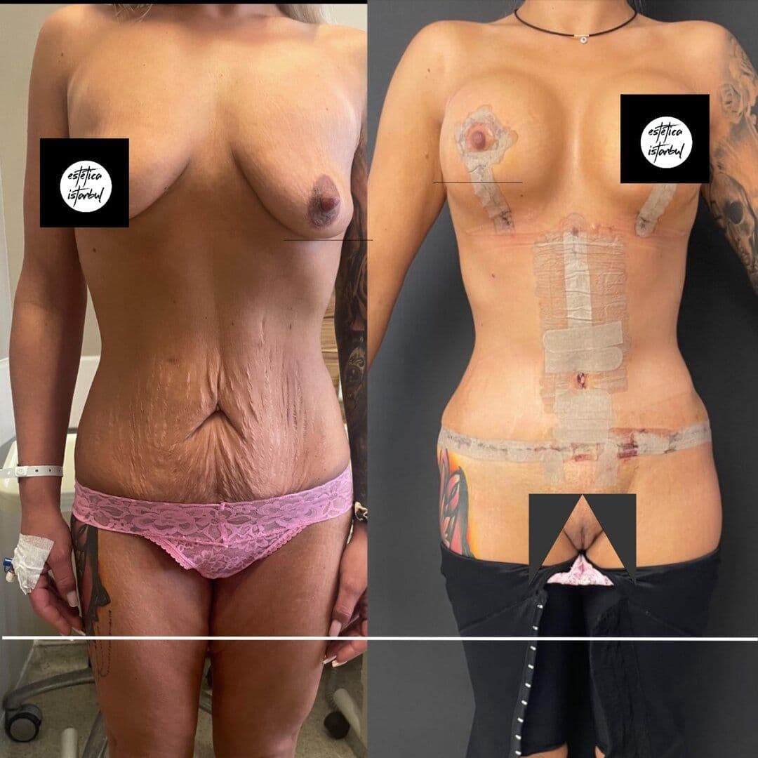 Que cirurgia emagrece mesmo? Referências honestas