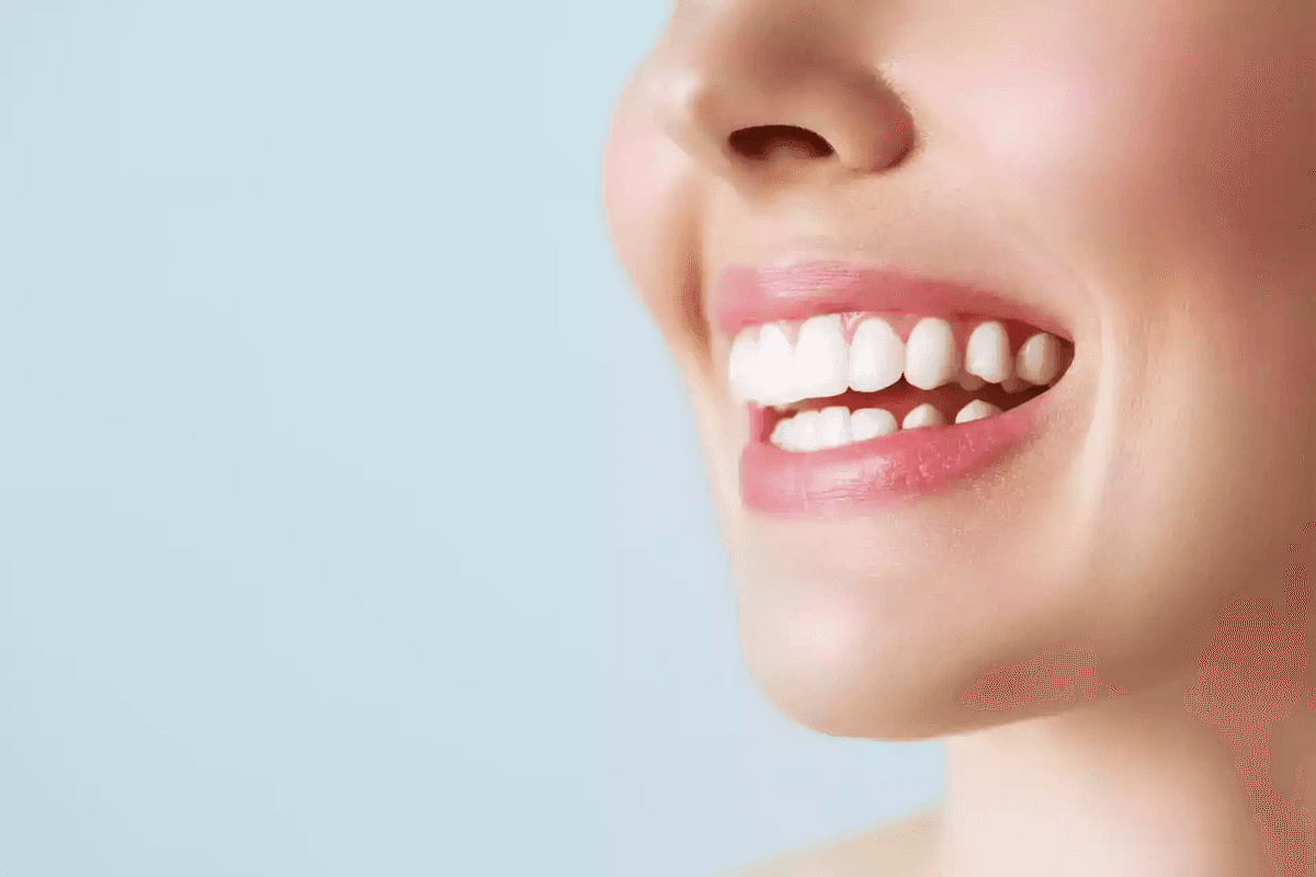 Hollywood Smile in Istanbul — Estetica Istanbul