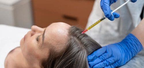 Causas y síntomas de la caída del cabello