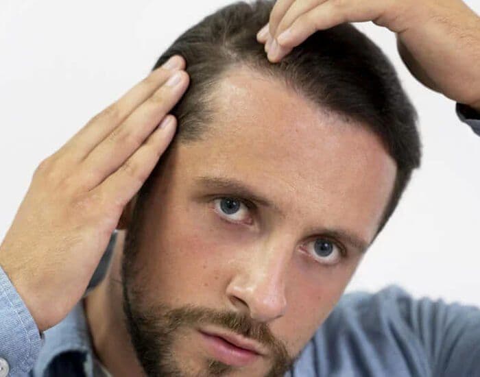 DHI vs. FUE Hair Transplant: Which is Better?