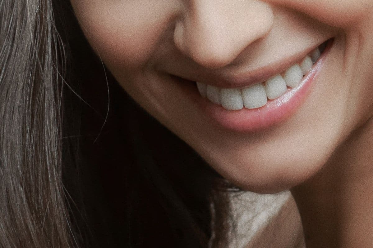 Wie viel kosten Zahnveneers? Vollständiger Preisvergleich: Türkei vs UK vs Deutschland (2026)