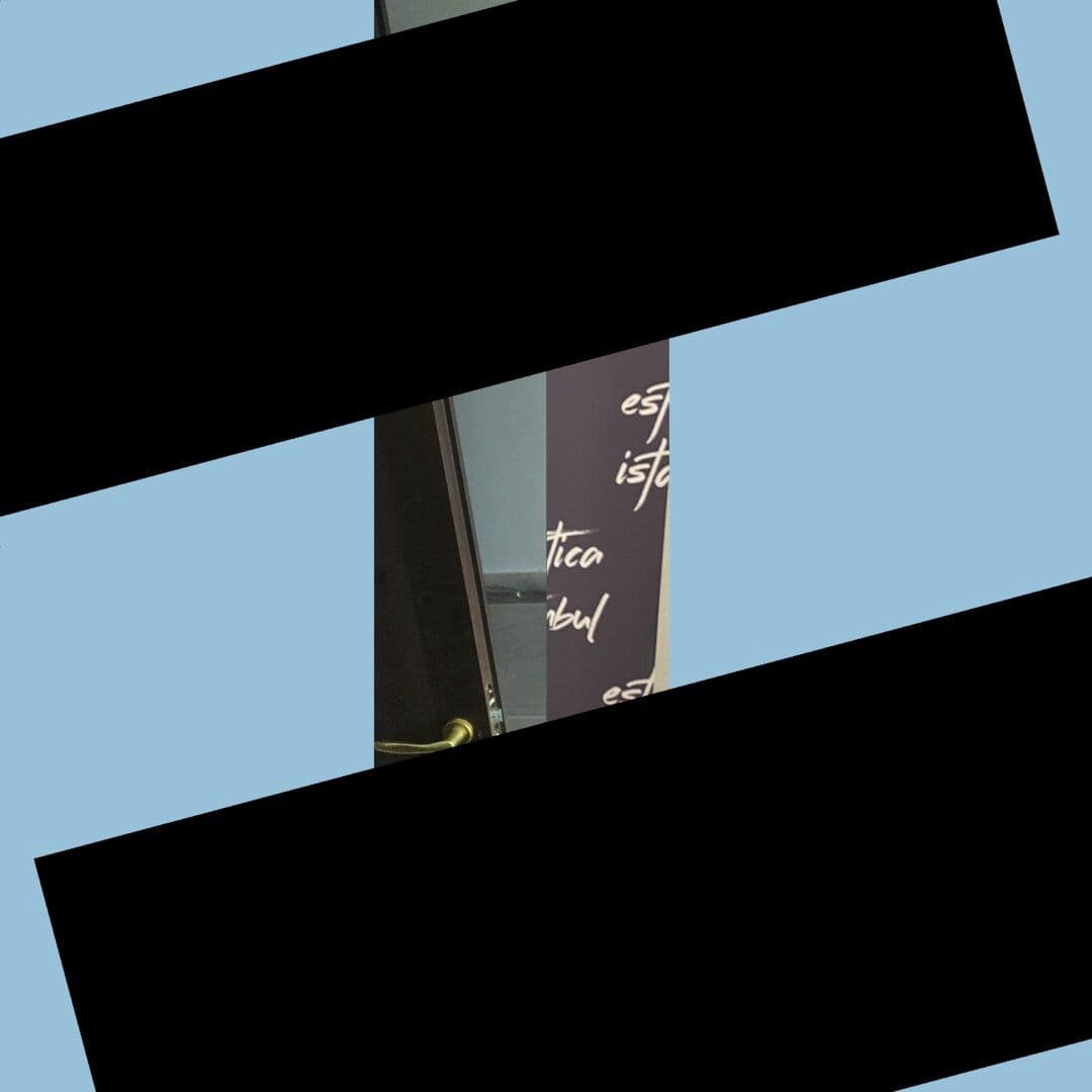 Hair Transplant Before & After