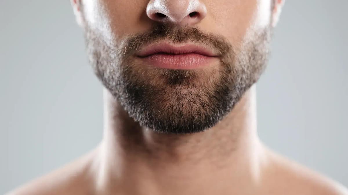 Beard Transplant in Istanbul — Estetica Istanbul