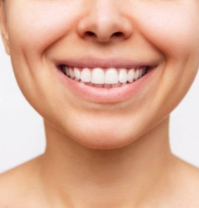 Relooking du sourire : de la consultation au résultat final