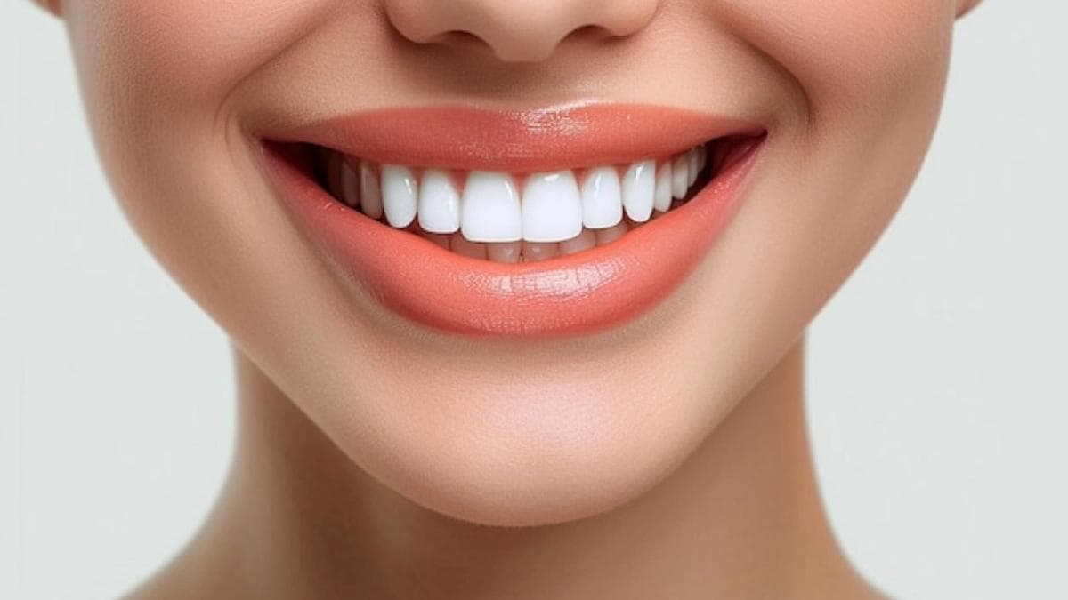 Teeth Whitening in Istanbul — Estetica Istanbul