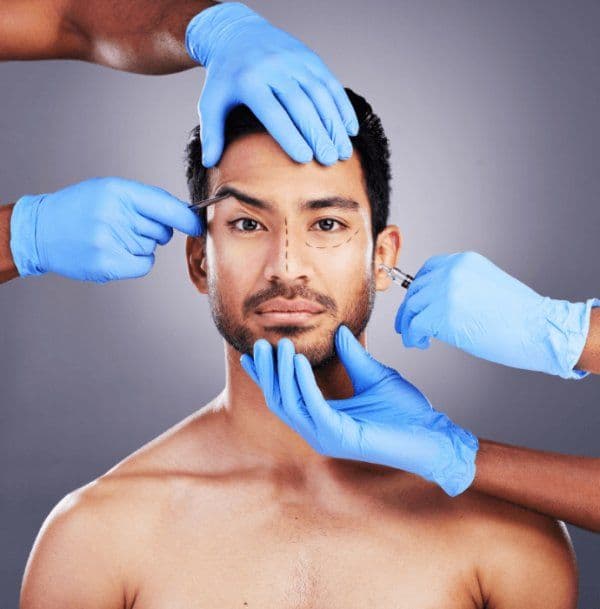 Lifting fallito: cosa devi sapere