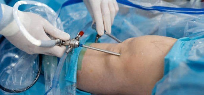 Is a Brazilian Butt Lift Permanent?